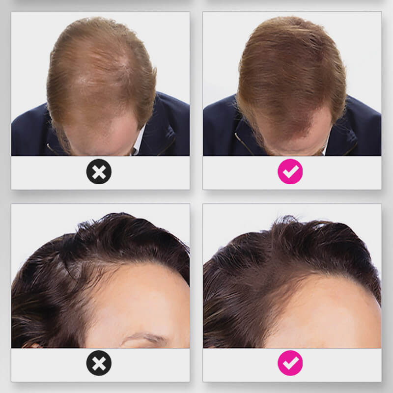 š„Limited time 50% off saleš„Hair Thickening Hair Building Fiber Powder