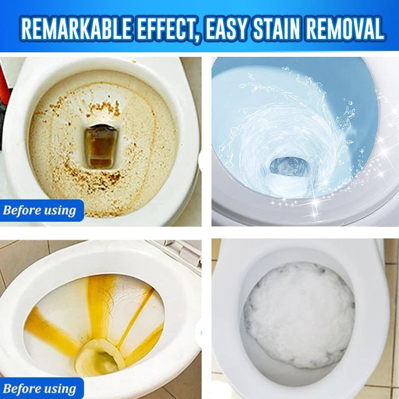 ?HOT SALE?Toilet Active Oxygen Agent(BUY 3 GET 1 FREE)