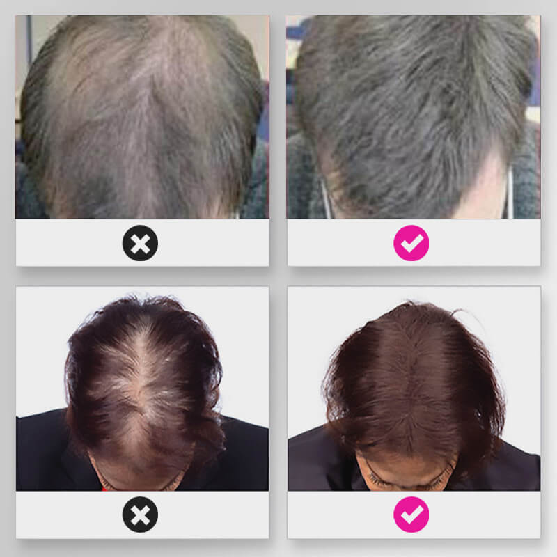 š„Limited time 50% off saleš„Hair Thickening Hair Building Fiber Powder