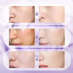 🎉Summer Hot Sale🎉All-in-One Niacinamide Cream