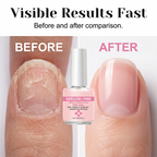 ⏳Time-Limited Special⏰Keratin Nail Strengthener & Moisturizer – Repair & Glossy Finish 🌟